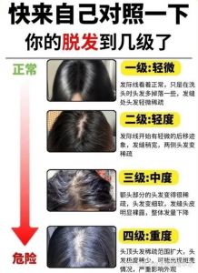 家里有女人的头发能查是谁吗_不明头发查得到是谁吗？看毛囊！