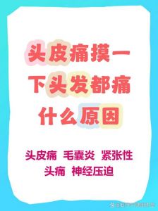 一揉头发头皮疼_揉头头皮疼？原因与缓解方法