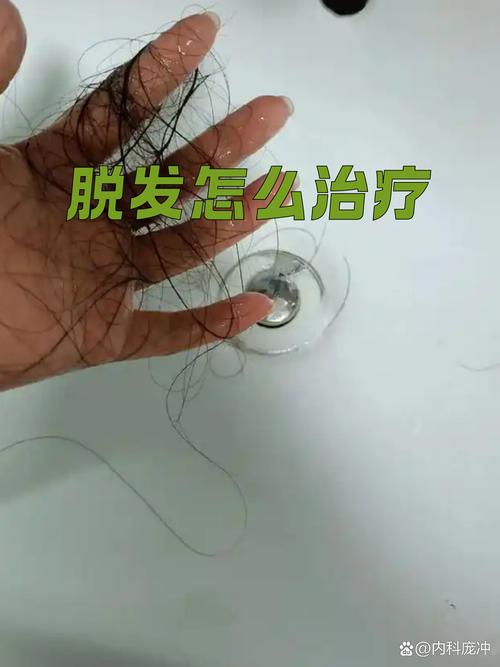 三尸神管掉头发吗_色贪酒欲扰身心，控之保健康发