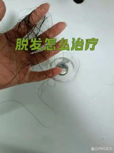 三尸神管掉头发吗_色贪酒欲扰身心，控之保健康发