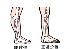 铁膝练法只练一式练哪种能速成_锻炼膝盖的硬功夫