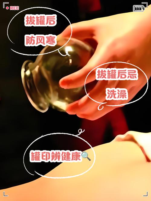 闪罐的操作要领是什么_闪罐快速疏通经络活血化瘀
