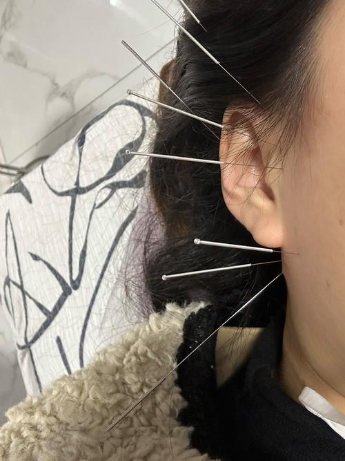 突聋听力恢复训练_突聋怎么办？保护听力是关键！