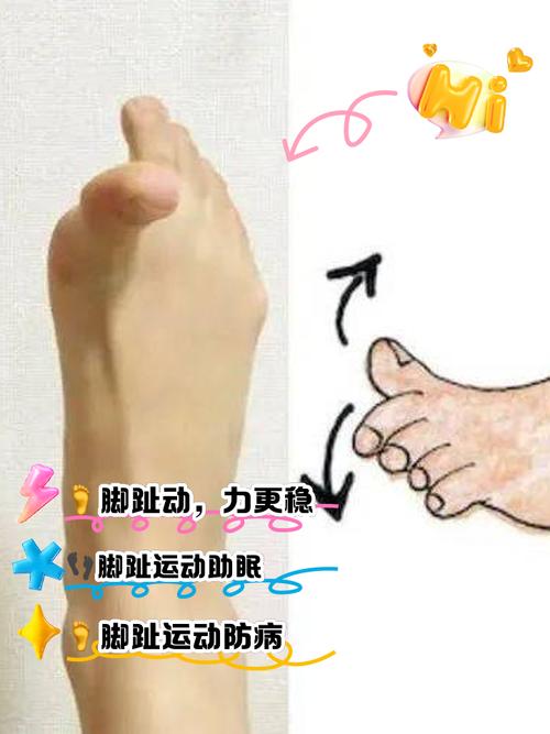 趾短伸肌怎么锻炼_足背关键肌，助你行走稳健